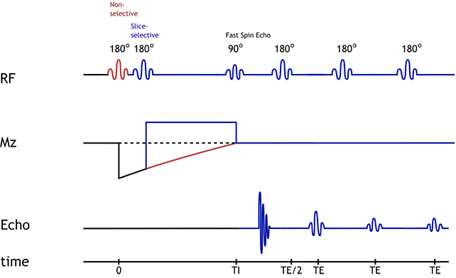 Double IR Black Blood Pulse Sequence