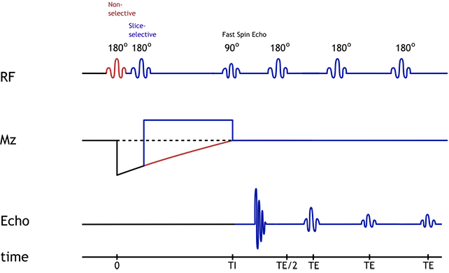 inversion recovery spin echo pulse sequence