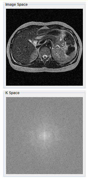 MRI Simulation