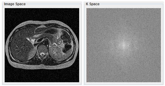 MRI Artifact Simulation